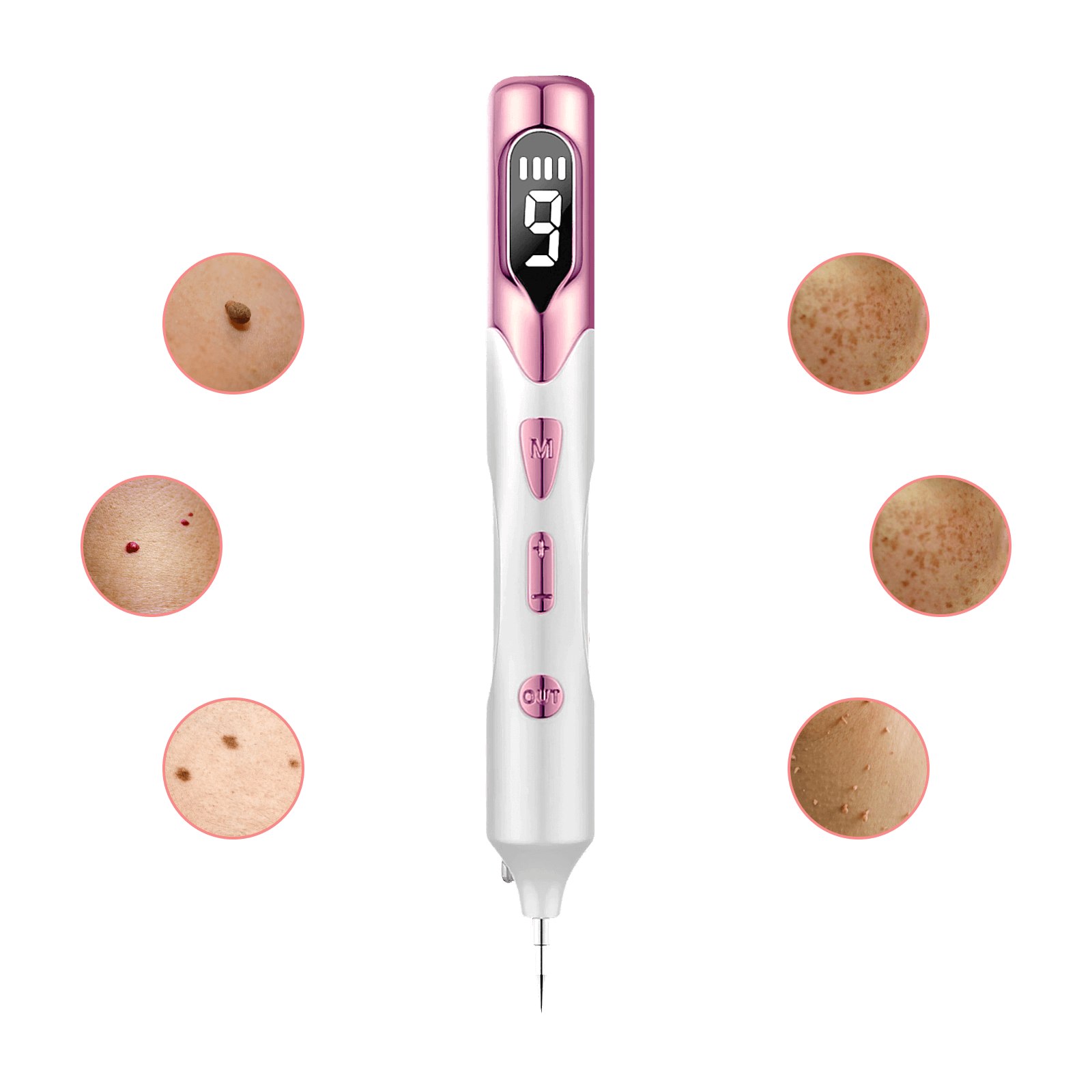 Skintify™ Remover Pen for Skin Tags, Moles, Warts, Age Spots, Freckles