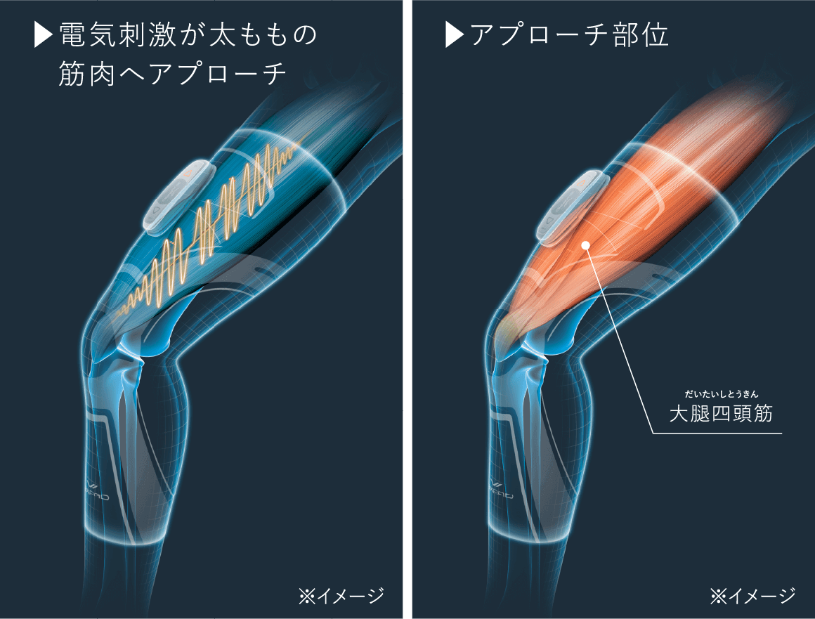 SIXPAD／ニーフィット【Sサイズ】コントローラー付き その2