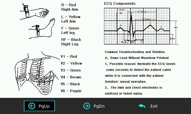 The ECG machine provides on-screen help and ECG placement guide.