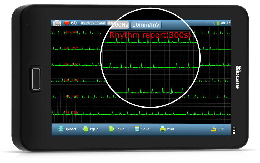最大 300 秒間の ECG リズムをキャプチャして分析可能