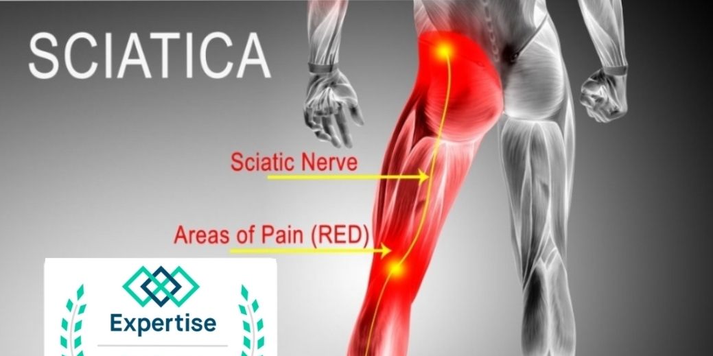 Overcoming Sciatic Nerve Pain promotional image
