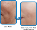 Comparison between an individual who uses only water and NANO SKIN Hyaluronic Acid Serum