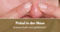 pickel in der nase