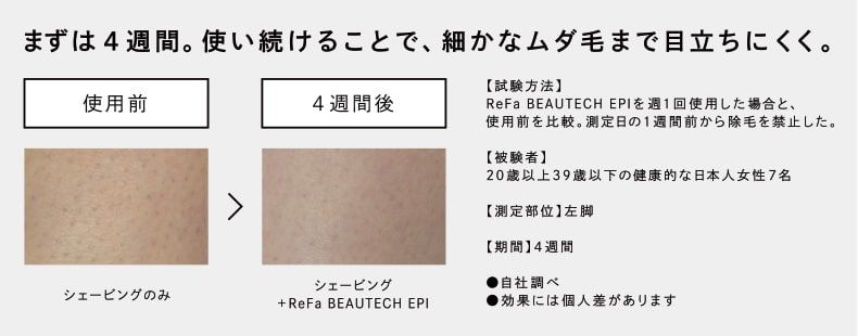 まずは4週間。使い続けることで、細かなムダ毛まで目立ちにくく。