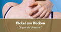 Pickel am Rücken Ursache