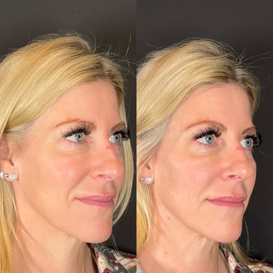 Transformation image 2