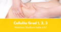 Welchen Cellulite Grad habe ich?