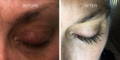 Nulastin Lash Serum Results Before After