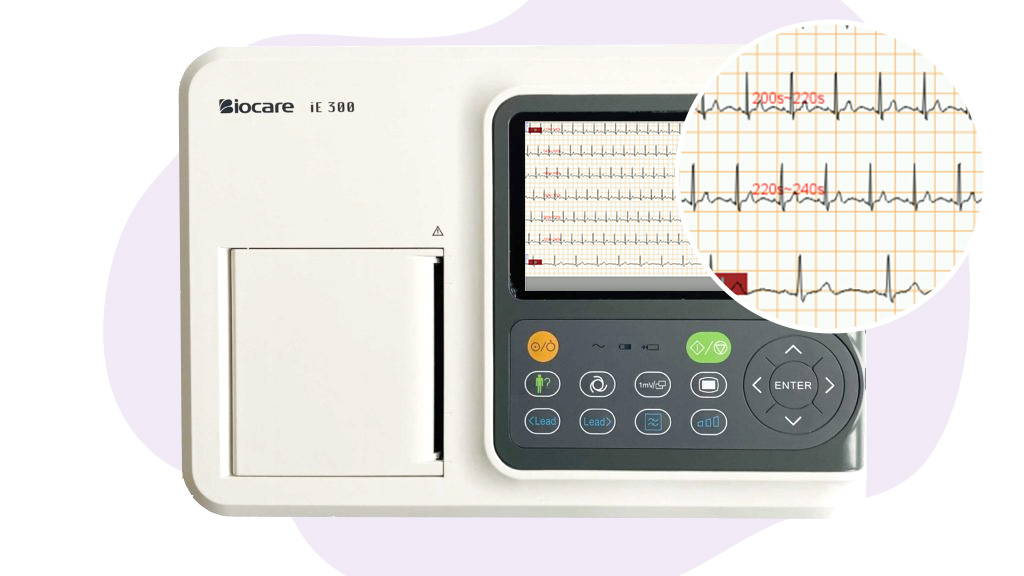 يمكن لآلة تخطيط القلب Wellue ذات 12 سلكًا مراجعة أشكال موجات تخطيط القلب لمدة 300 ثانية