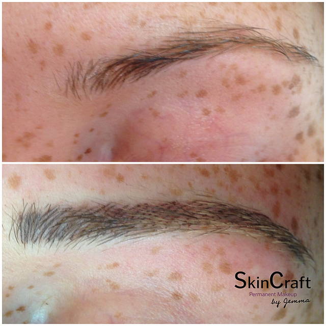 MICROPIGMENTATION | Skincraft