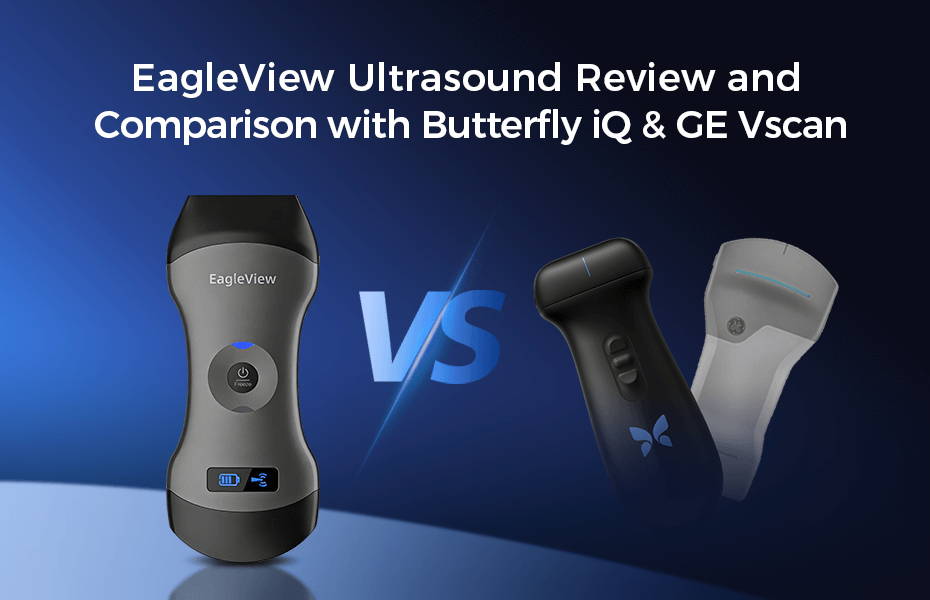 EagleView Handheld Ultrasound Review and Comparison with Butterfly iQ & GE Vscan