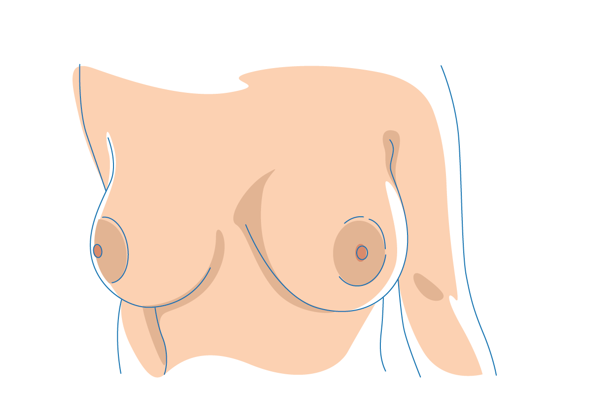 Sex Doll Breasts
