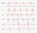 EKG-Anzeigediagramm
