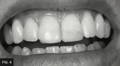 Black and white picture of composite mockup placed