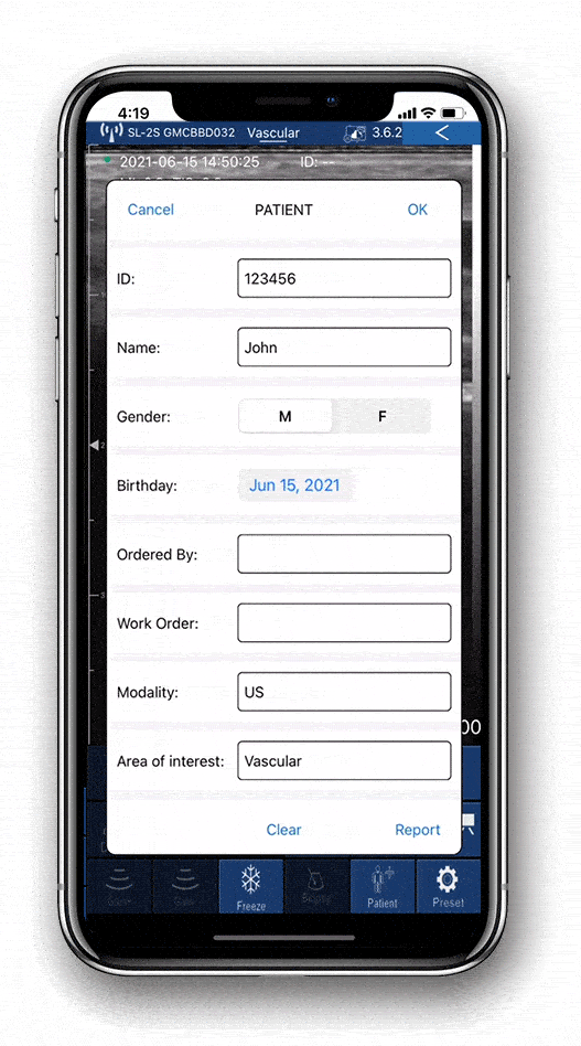 Manage patient's ultrasound image in the app with EagleView ultrasound.