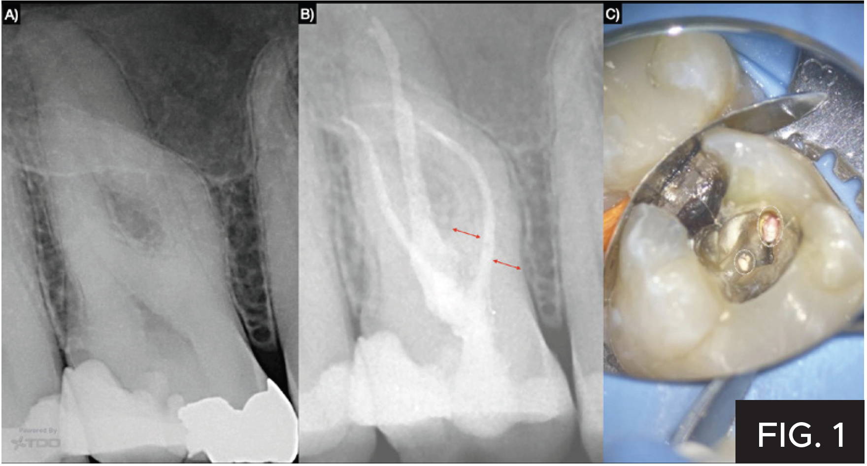 Dr. Nadeau case: figure 1