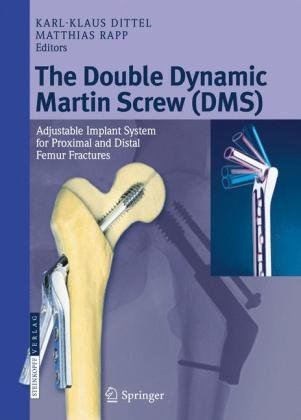 Le Double Dynamic Martin Screw (DMS)