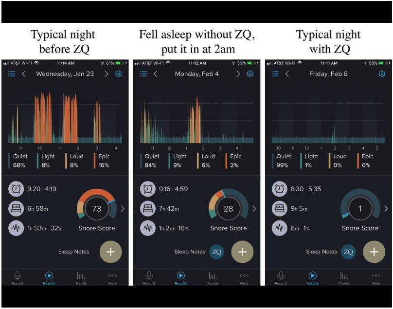 App to track snoring