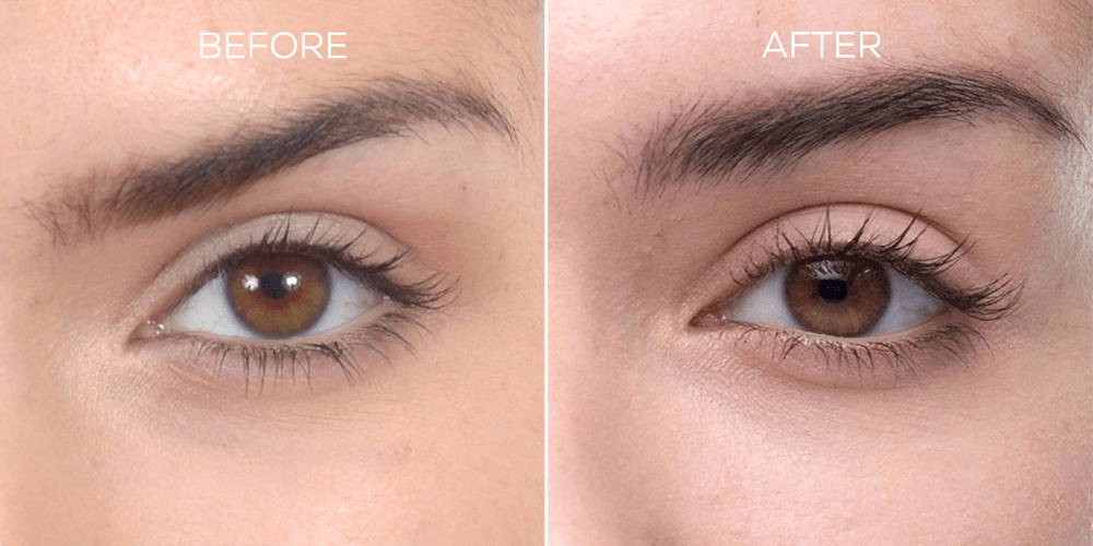 Before and After Results Using BROW Shape Altering Serum with Keracyte® Elastin Complex