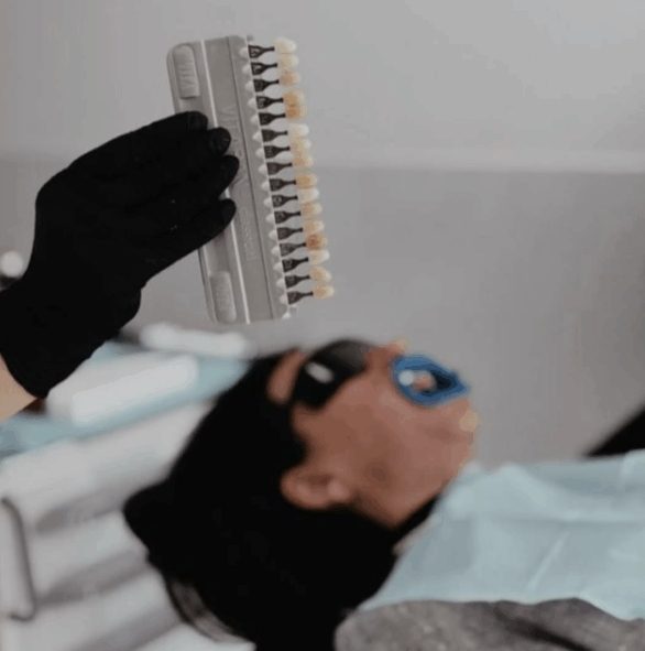 Bright and White Teeth Whitening