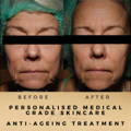 Before & After Pictures Dr Sknn Wilmslow Cheshire