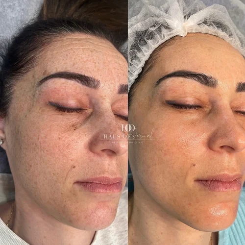 Haus of Dermal Voucher - Image 5