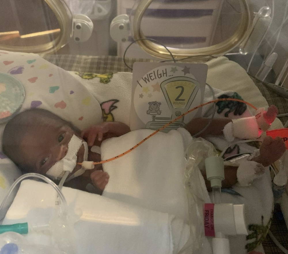 preemie baby with OG feeding tube in NICU with NICU Milestone card "I weigh 2 pounds" photo by https://www.instagram.com/adam.diaz42/