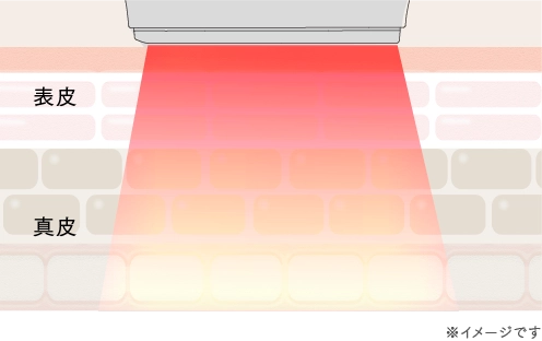 アプローチ