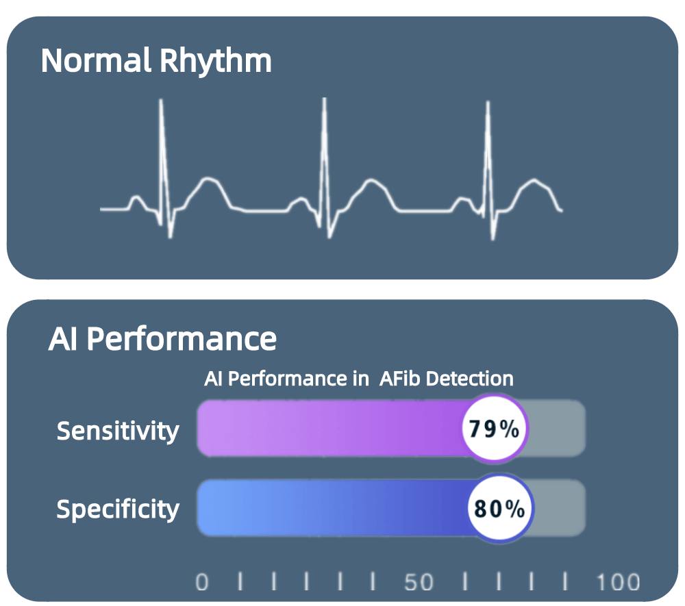 أداء الذكاء الاصطناعي في تشخيص AFib ، وتشخيص AFib ، وتحليل AI لـ AFib