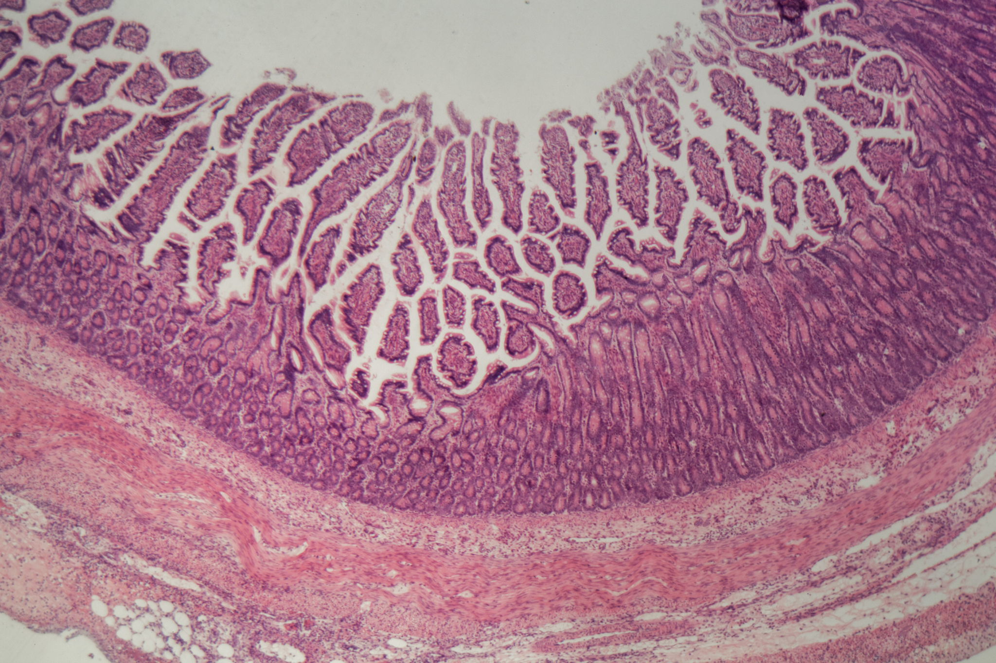 Your 4-Step Microscopic Colitis Treatment Plan - Dr. Michael Ruscio, DC