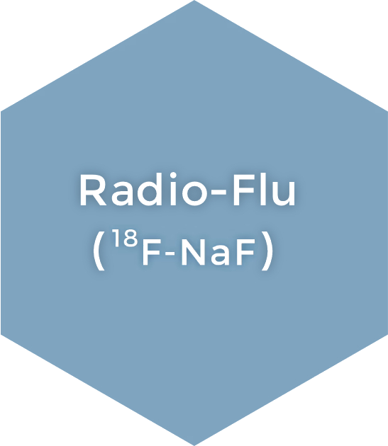 Radio-Flu (¹⁸F-NaF)
