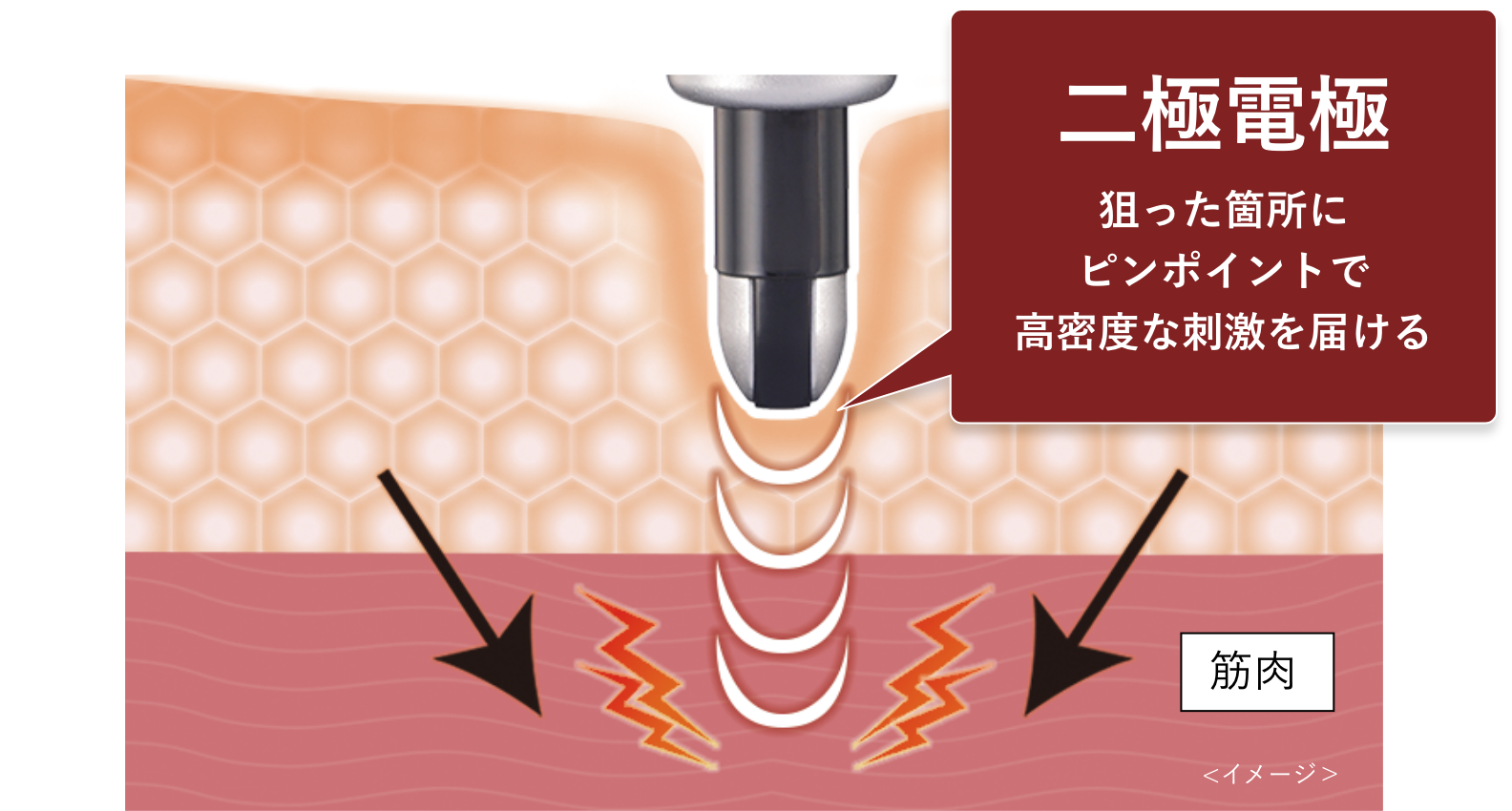 二極電極