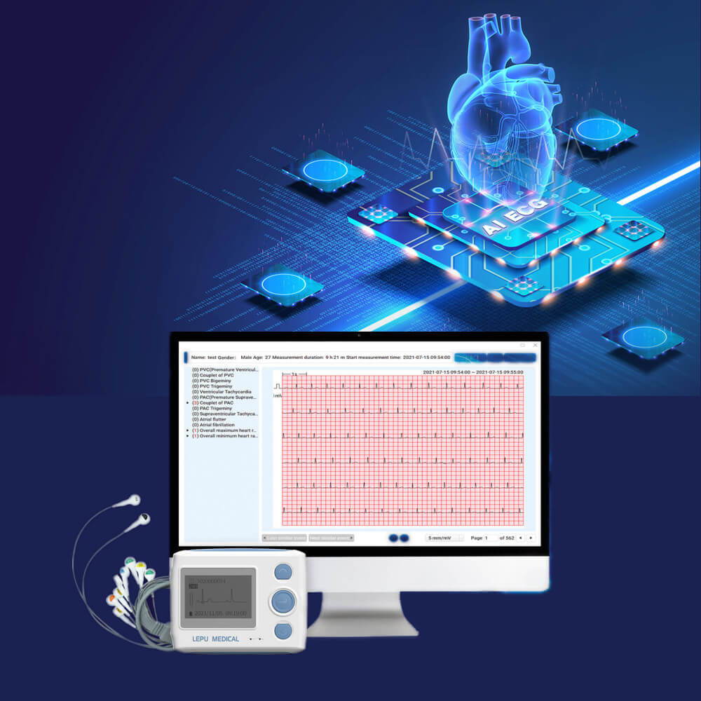 التقط أحداث ECG / EKG غير الطبيعية باستخدام جهاز هولتر مزود بـ 12 سلكًا مزودًا بتحليل بالذكاء الاصطناعي