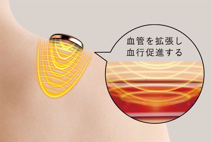 高周波治療器とは