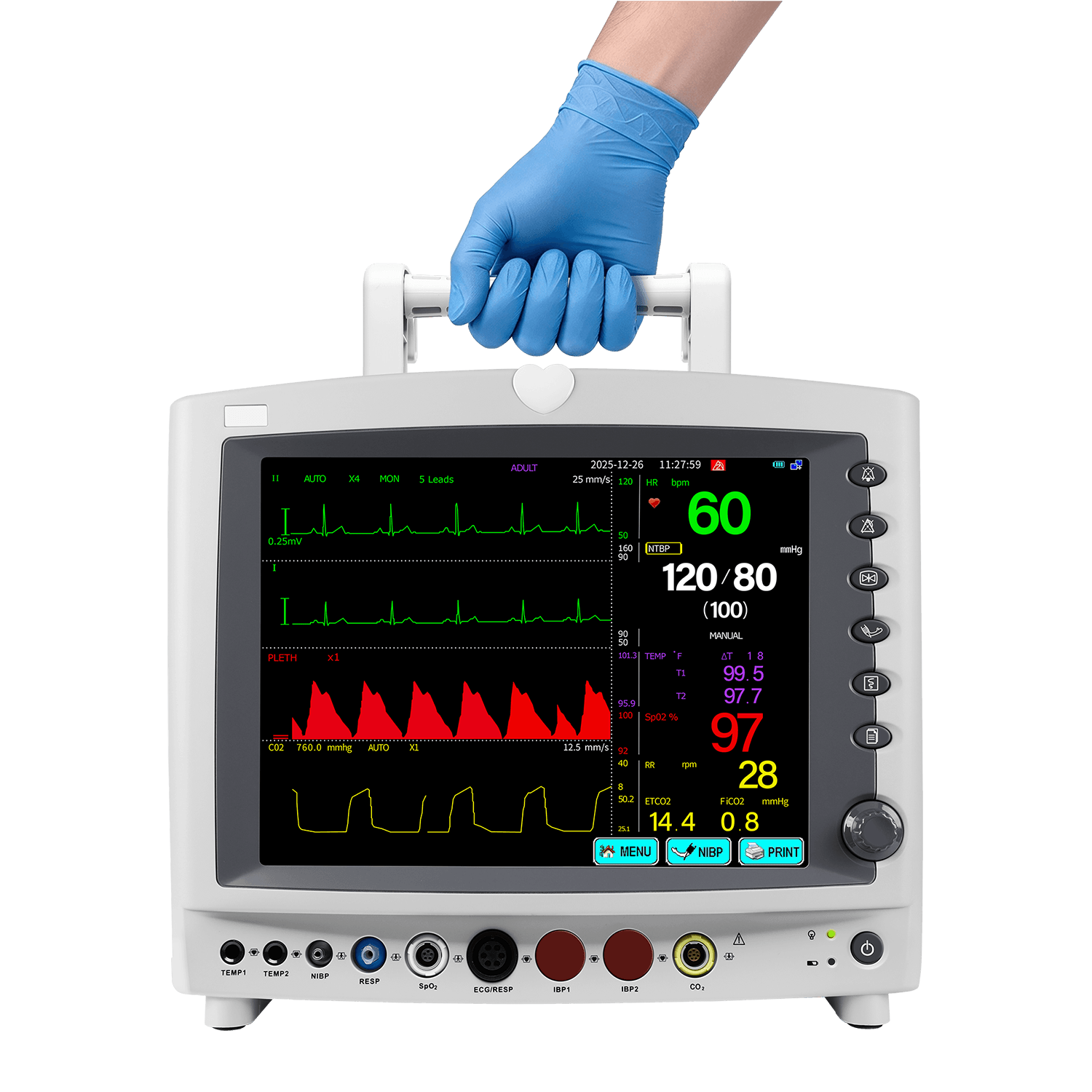 portable patient monitor