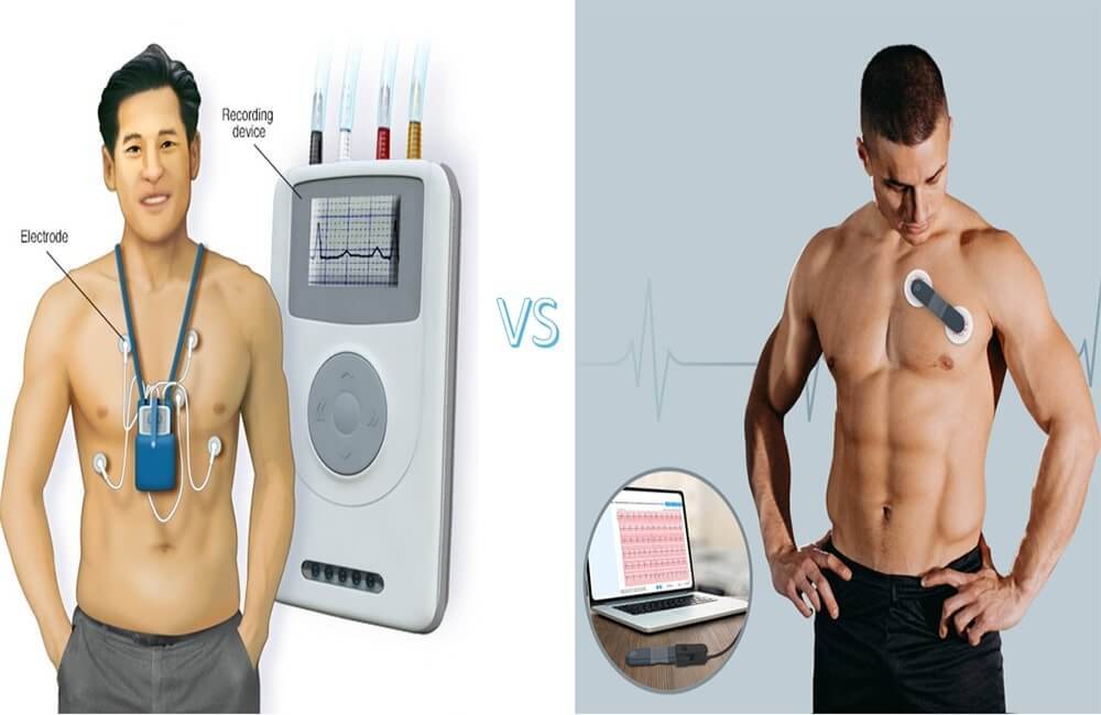 Holter-Monitor VS Wellue 24-Stunden-EKG-Rekorder mit KI-Analyse