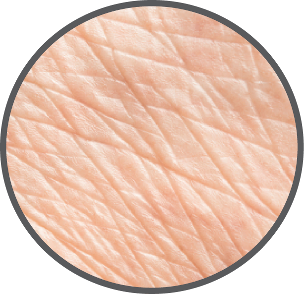Lines and Wrinkled Skin Zoomed In | Revoderm