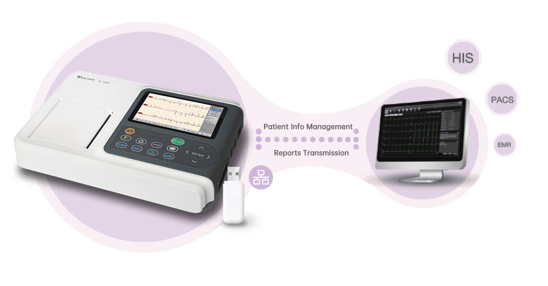 Wellue 12리드 ECG 기계는 ECG 보고서를 병원에 직접 쉽게 전송할 수 있습니다.