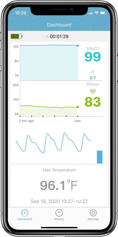 vital signs monitor with mobile APP