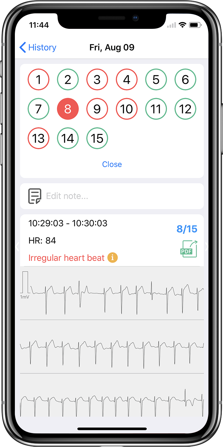 Wellue duoek EKG informes gratuitos, aplicación ekg, aplicación kardia