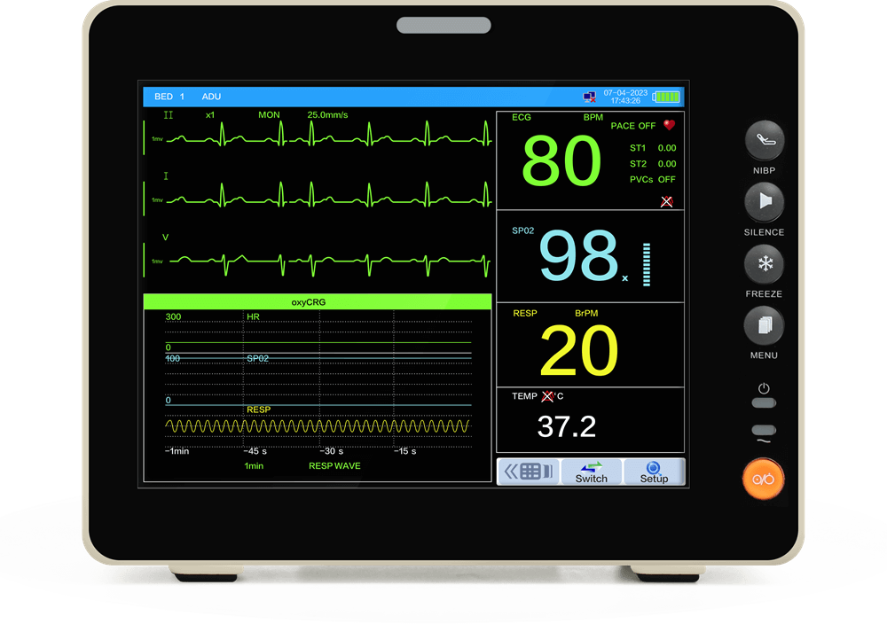 monitor paziente con visualizzazione dinamica dell'ossigeno
