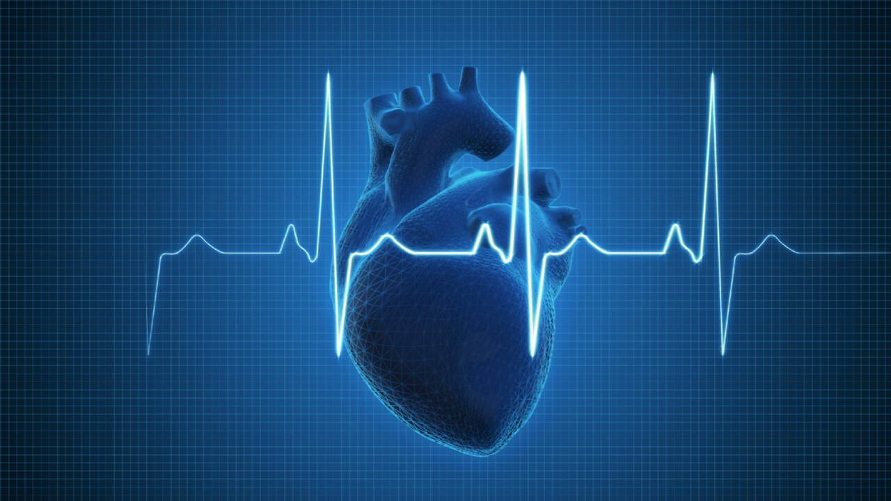 Arrhythmia, heart arrhythmia, cardiac arrhythmia, what is Arrhythmia