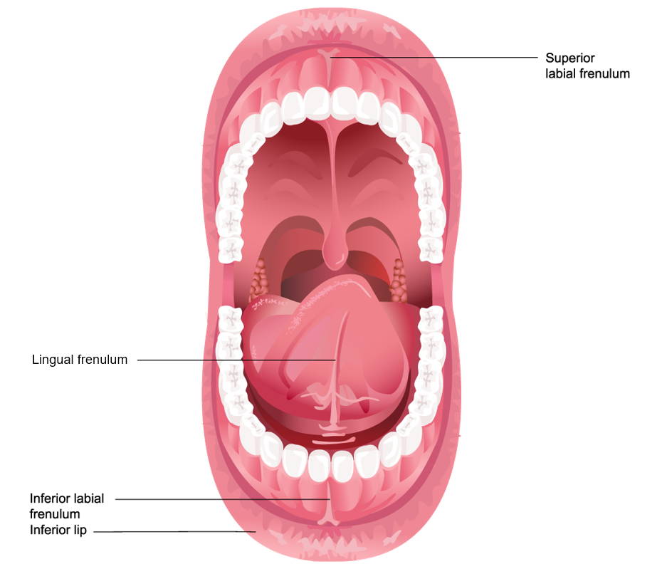 Oral Frenulums: Frenectomy of tongue & lip ties
