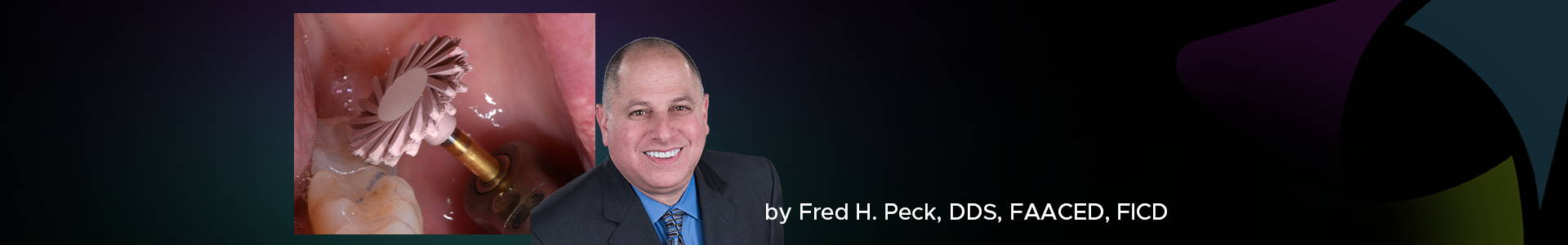 a blog banner featuring a clinical image of a ceramic polishing technique and dr. fred peck