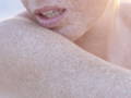 model's skin