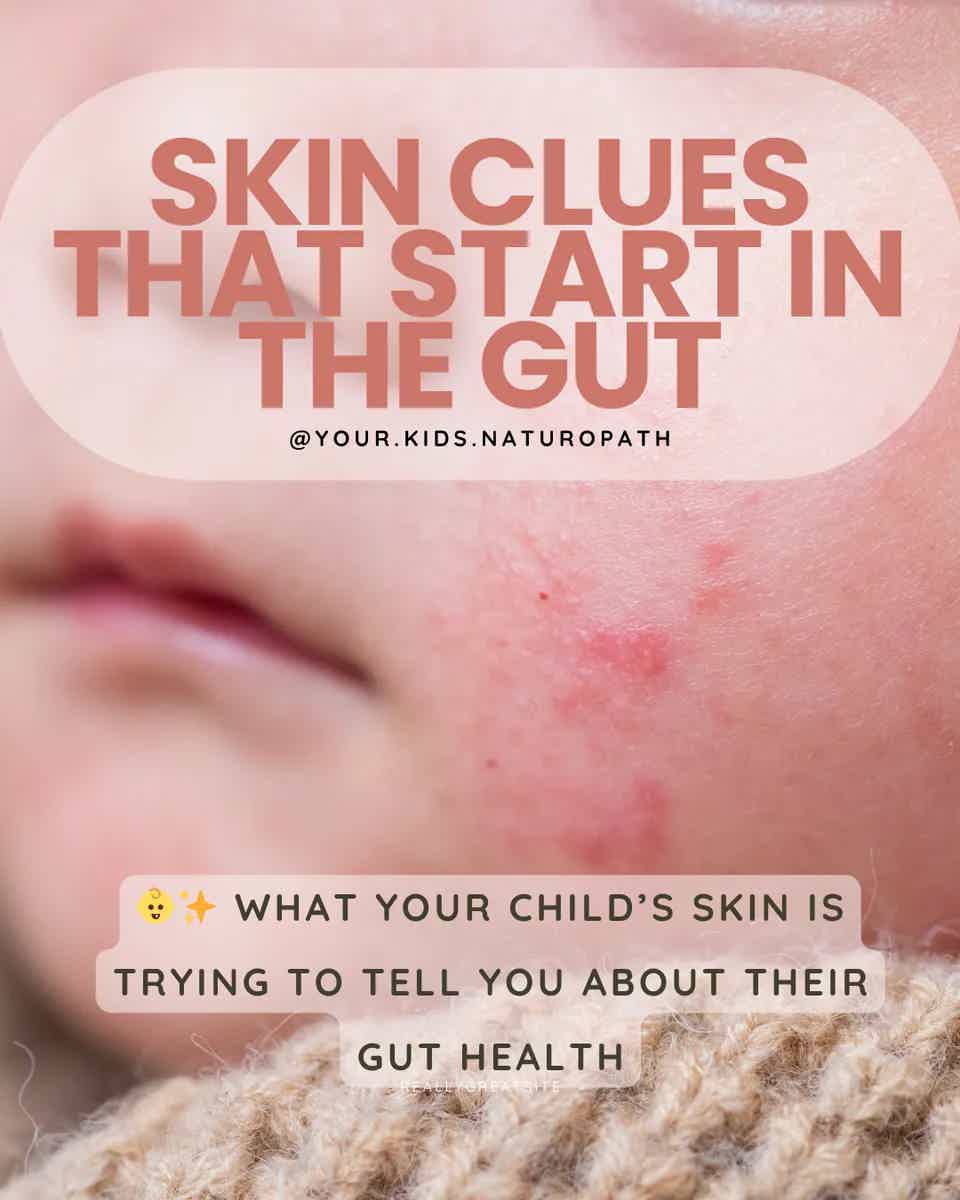 🌿 The Gut–Skin Connection: What’s Happening Inside