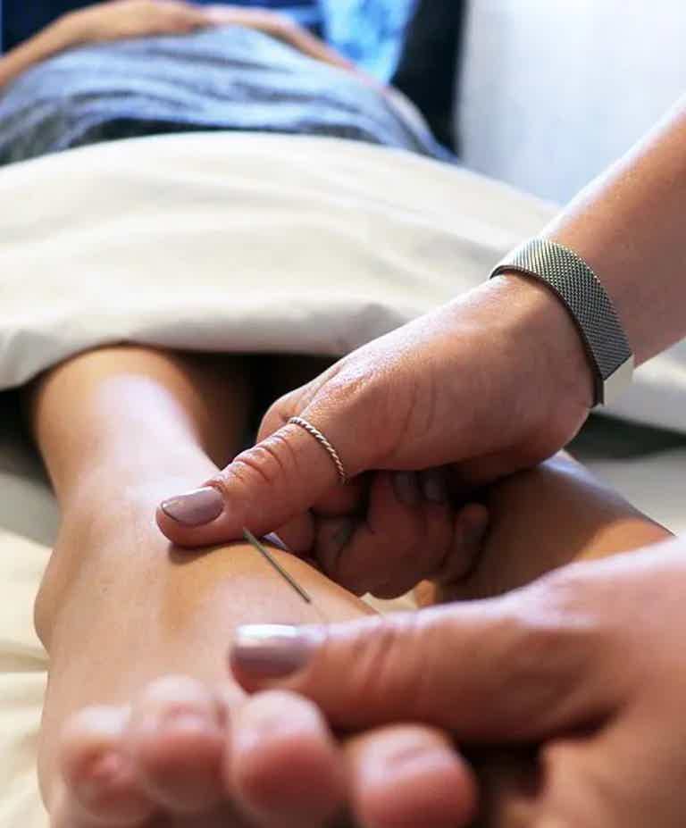 Acupuncture session: a practitioner inserts a thin needle into a patient's wrist while holding the hand.