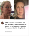 Before and after image of Raw Beauty customer Olivia showing her results after 2 months 