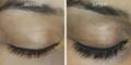 Nulastin Lash Serum Results Before After