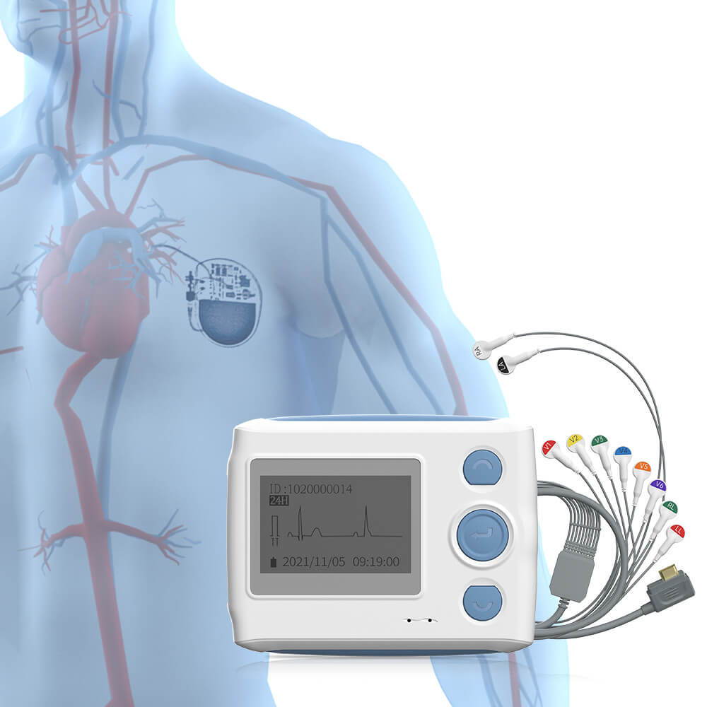 جهاز هولتر من wellue يعمل على مدار 24 ساعة مع كشف منظم ضربات القلب
